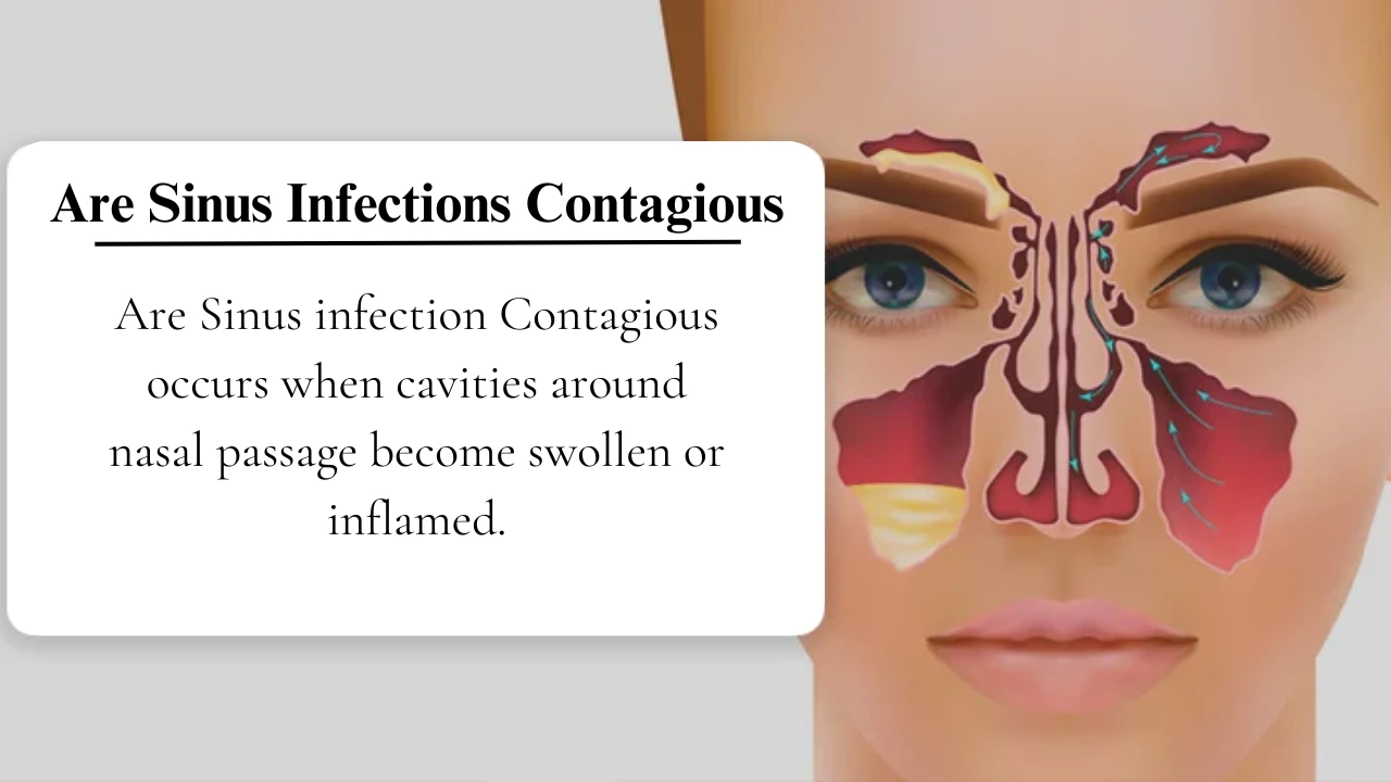 Are Sinus Infections Contagious The Facts and Myths